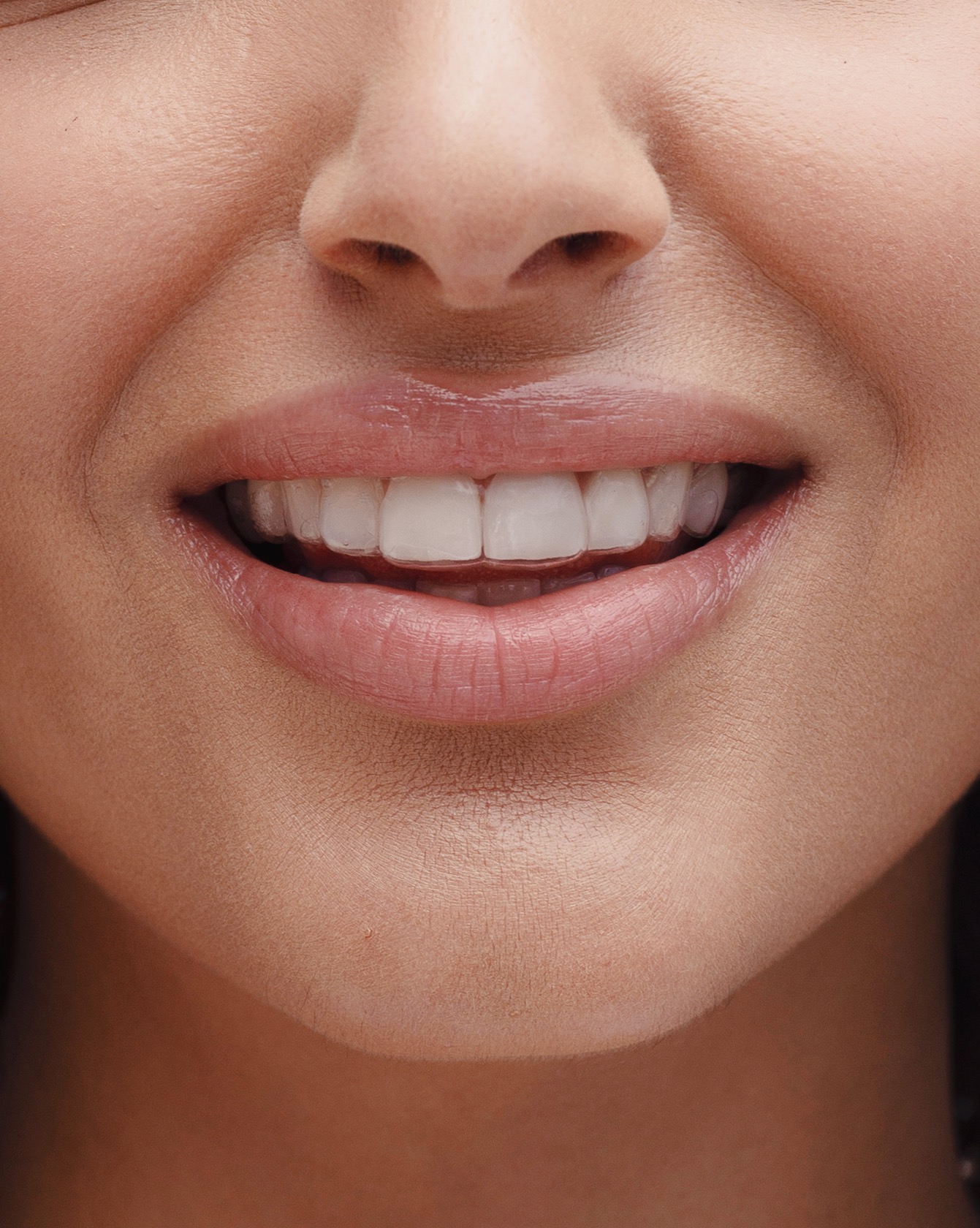 Align Right – Diamondhead Dental Lab